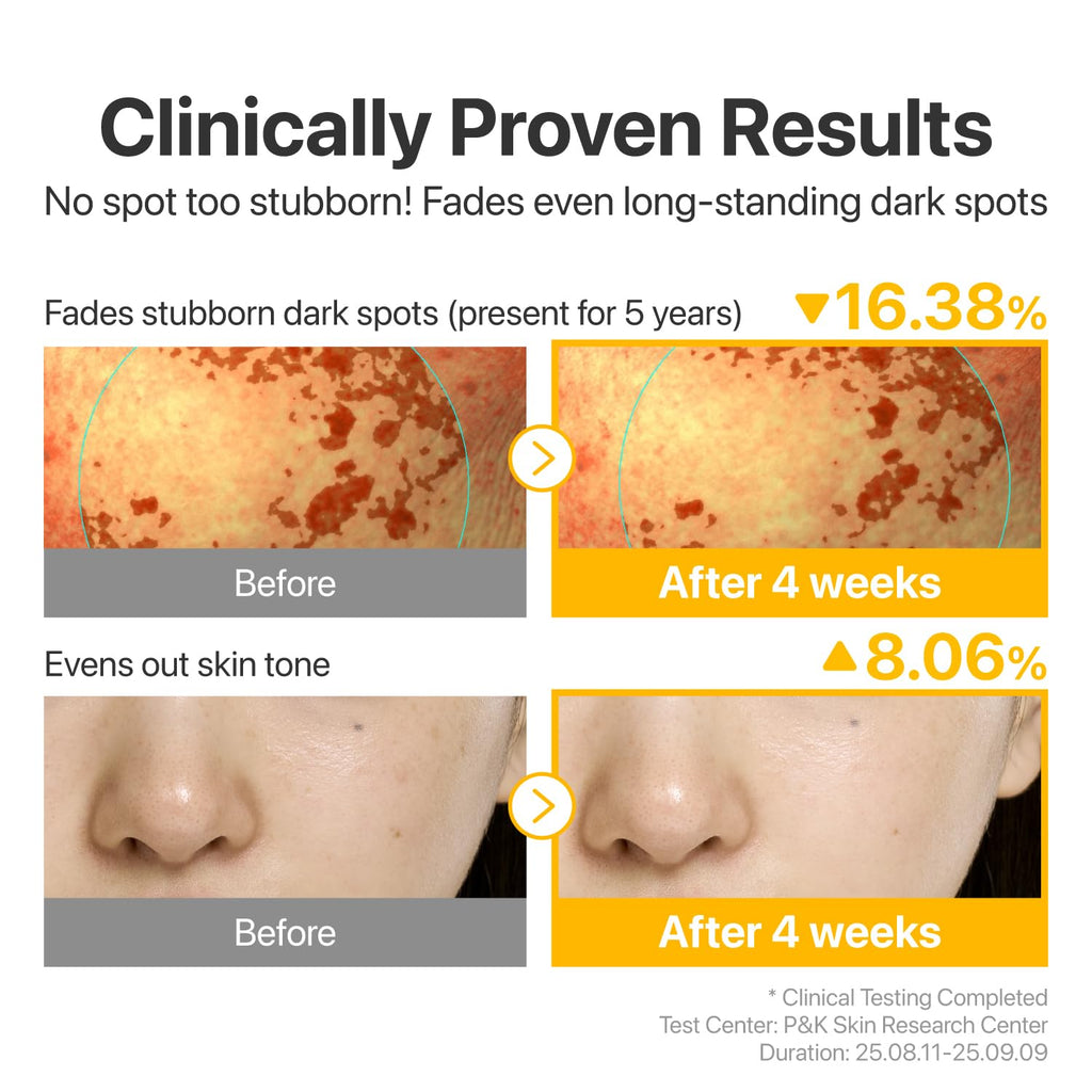 numbuzin No.5 Vitamin Concentrated Serum, Dark Spot Care, Glutathione & Vitamin Serum, Korean Skincare, Tranexamic Acid 4%, Niacinamide 5%, for a Radiant-Looking Glow 1.01 fl oz