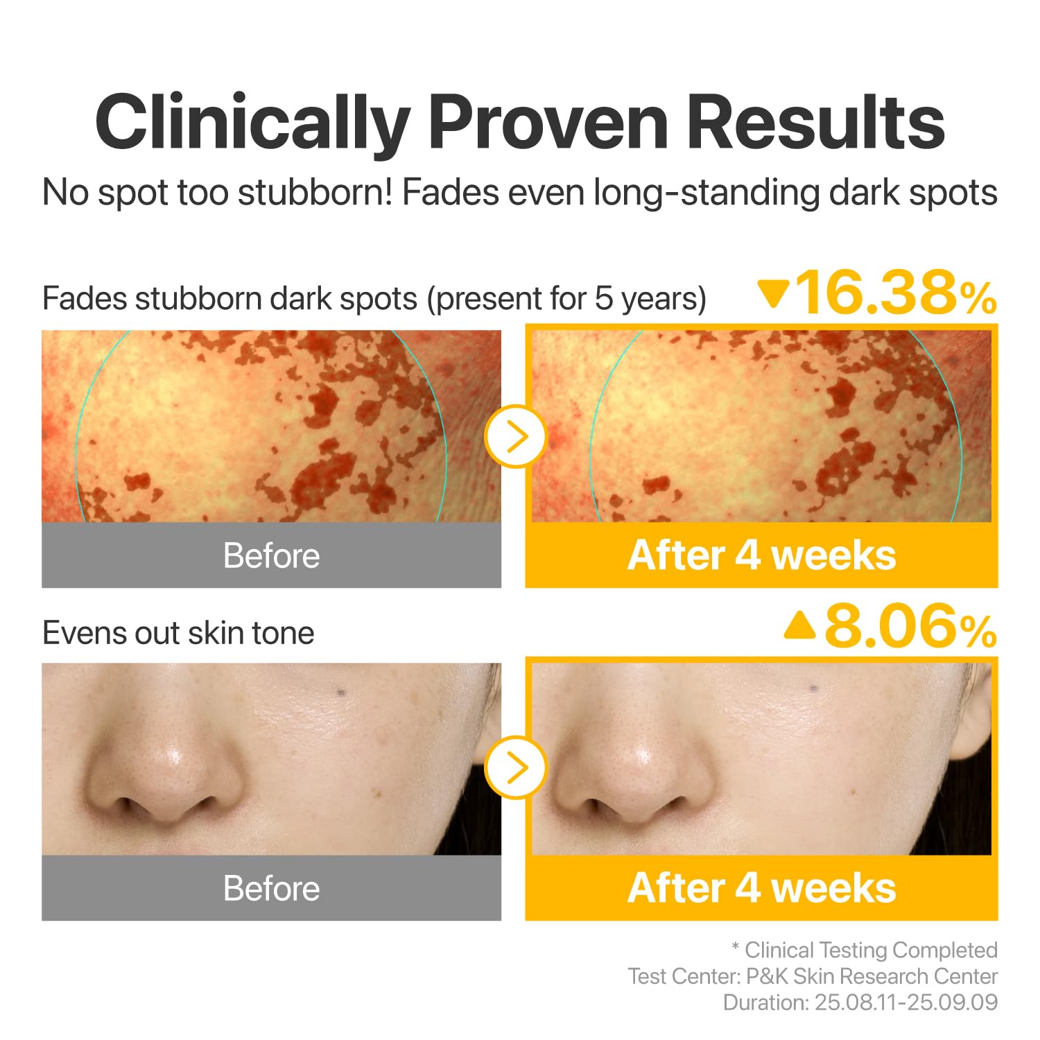 numbuzin No.5 Vitamin Concentrated Serum, Dark Spot Care, Glutathione & Vitamin Serum, Korean Skincare, Tranexamic Acid 4%, Niacinamide 5%, for a Radiant-Looking Glow 1.01 fl oz