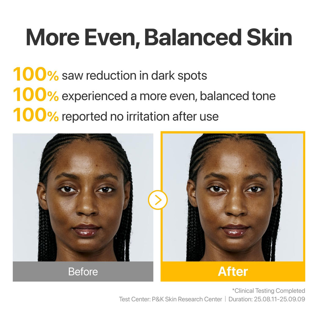 numbuzin No.5 Vitamin Concentrated Serum, Dark Spot Care, Glutathione & Vitamin Serum, Korean Skincare, Tranexamic Acid 4%, Niacinamide 5%, for a Radiant-Looking Glow 1.01 fl oz