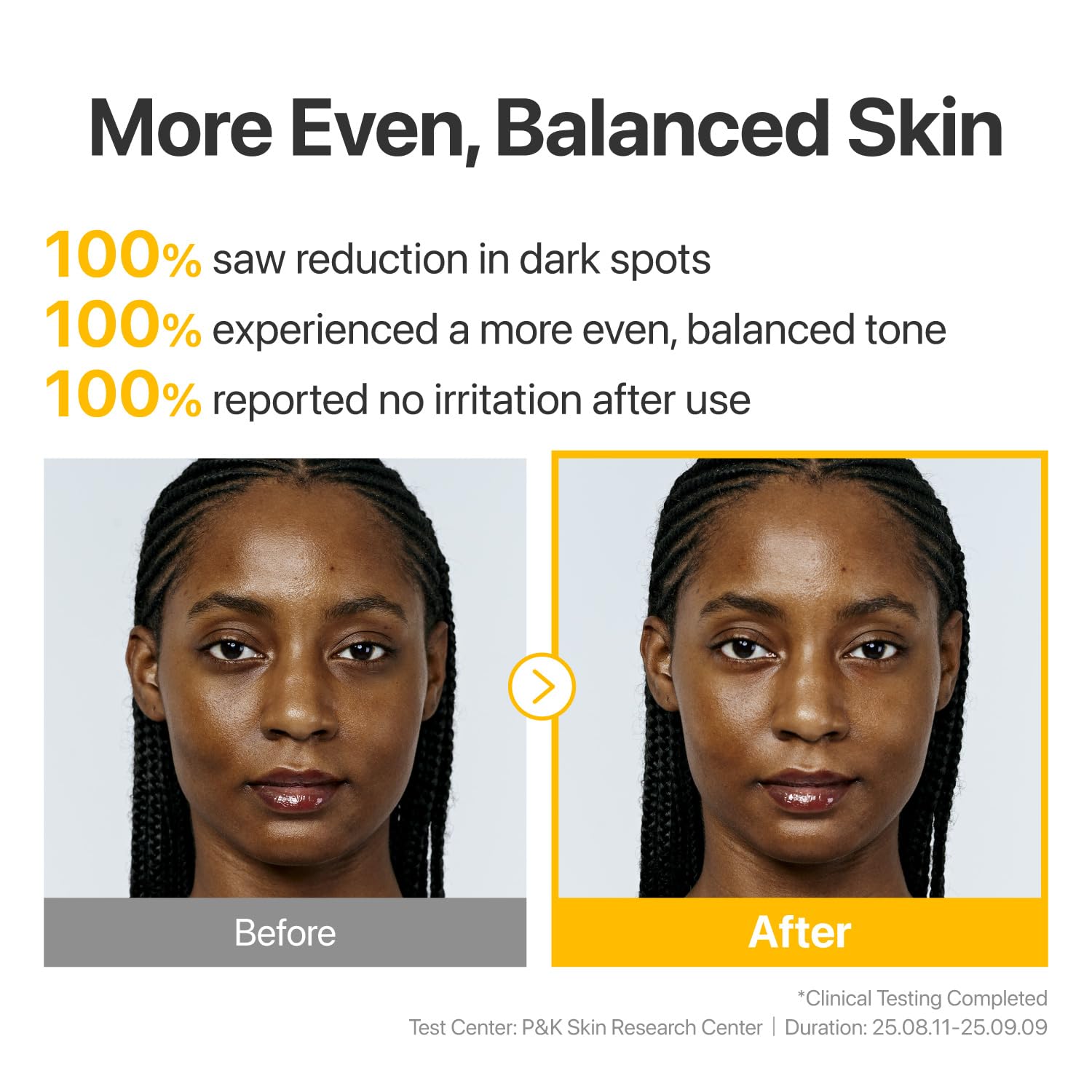 numbuzin No.5 Vitamin Concentrated Serum, Dark Spot Care, Glutathione & Vitamin Serum, Korean Skincare, Tranexamic Acid 4%, Niacinamide 5%, for a Radiant-Looking Glow 1.01 fl oz